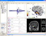 Neuroscan CURRY多模式神經影像